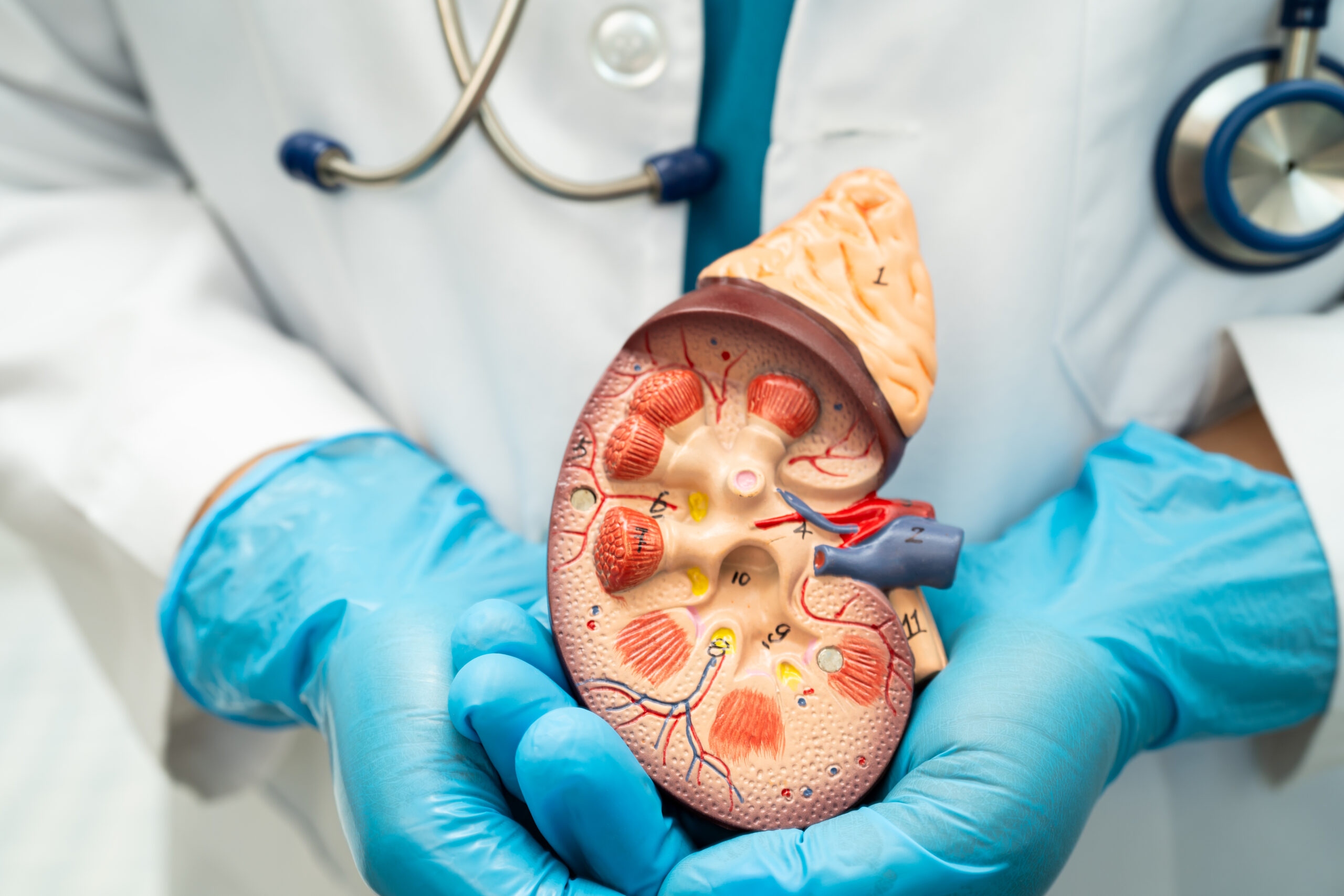 Kidney disease, Chronic kidney disease ckd, Doctor hold human mo