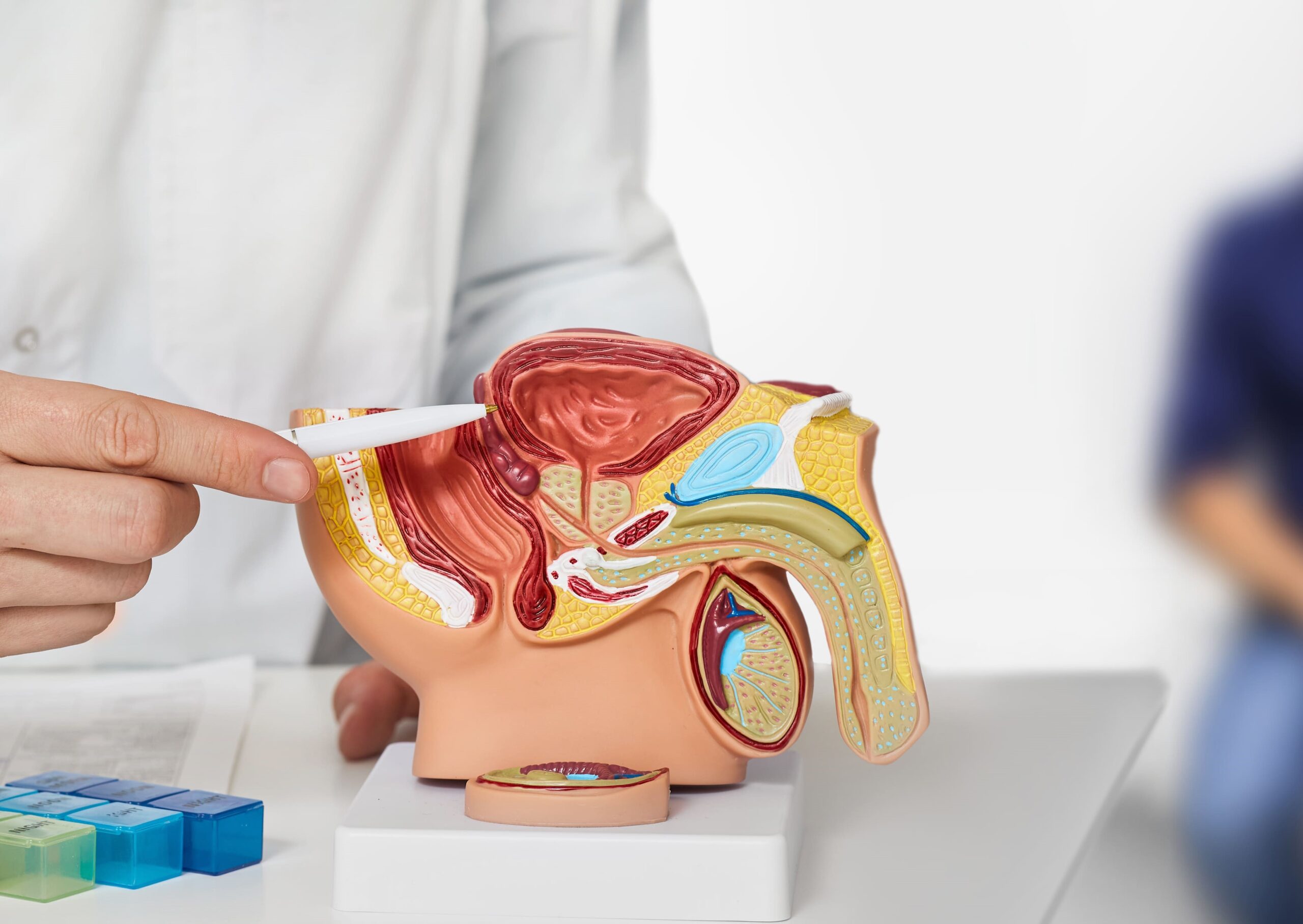 Bladder cancer d