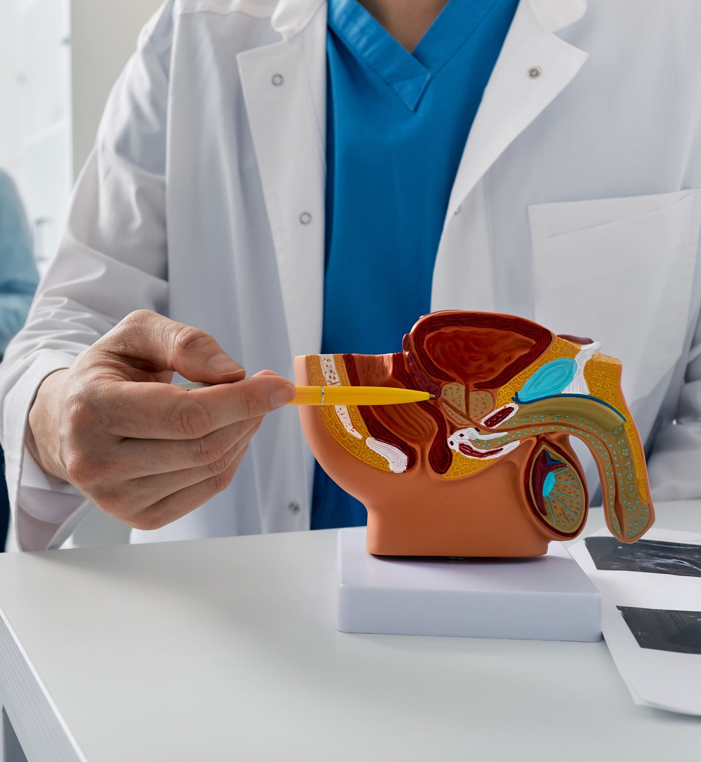 focal therapy for prostate cancer d