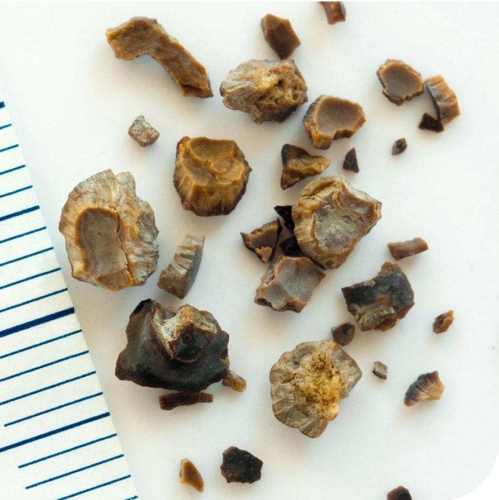 Image kidney treated mob